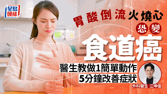 胃酸倒流火燒心恐變食道癌，醫生教做1簡單動作舒緩