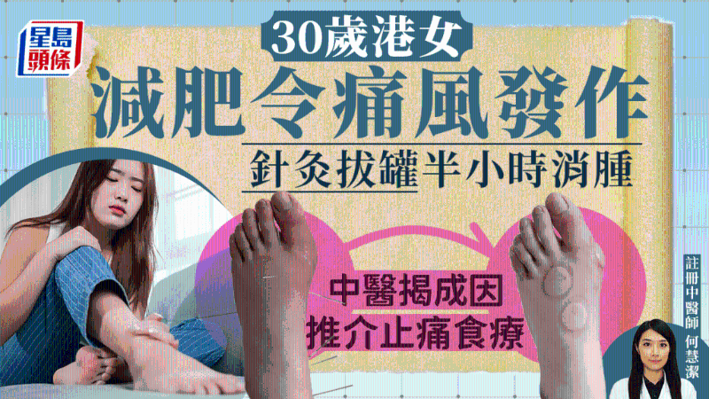 港女減肥引發痛風，中醫治療30分鐘消腫，揭4方法預防痛風
