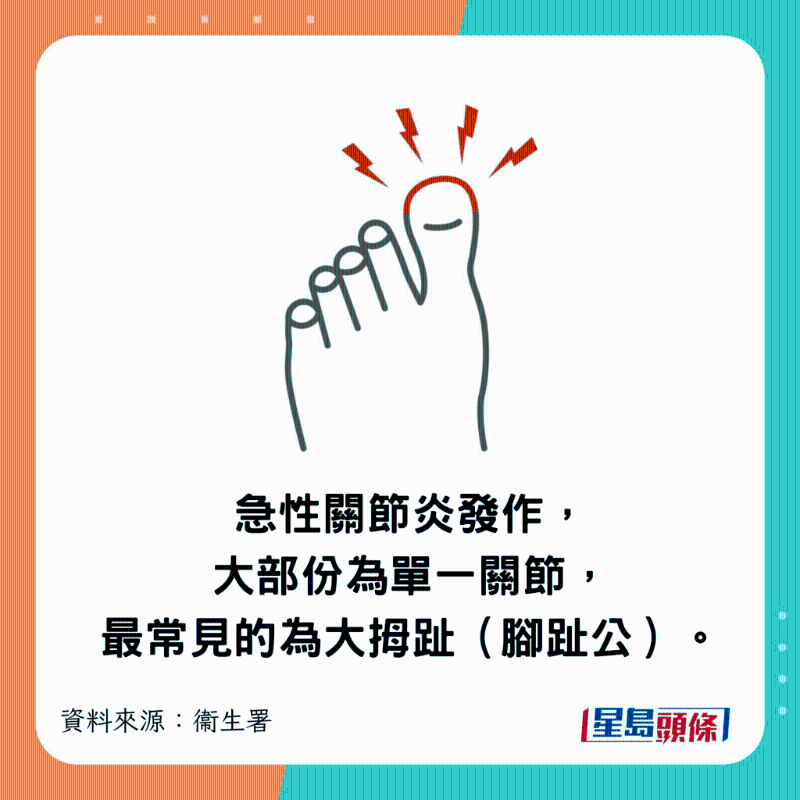 急性關節炎發作，大部份為單一關節，最常見的為大拇趾（腳趾公）