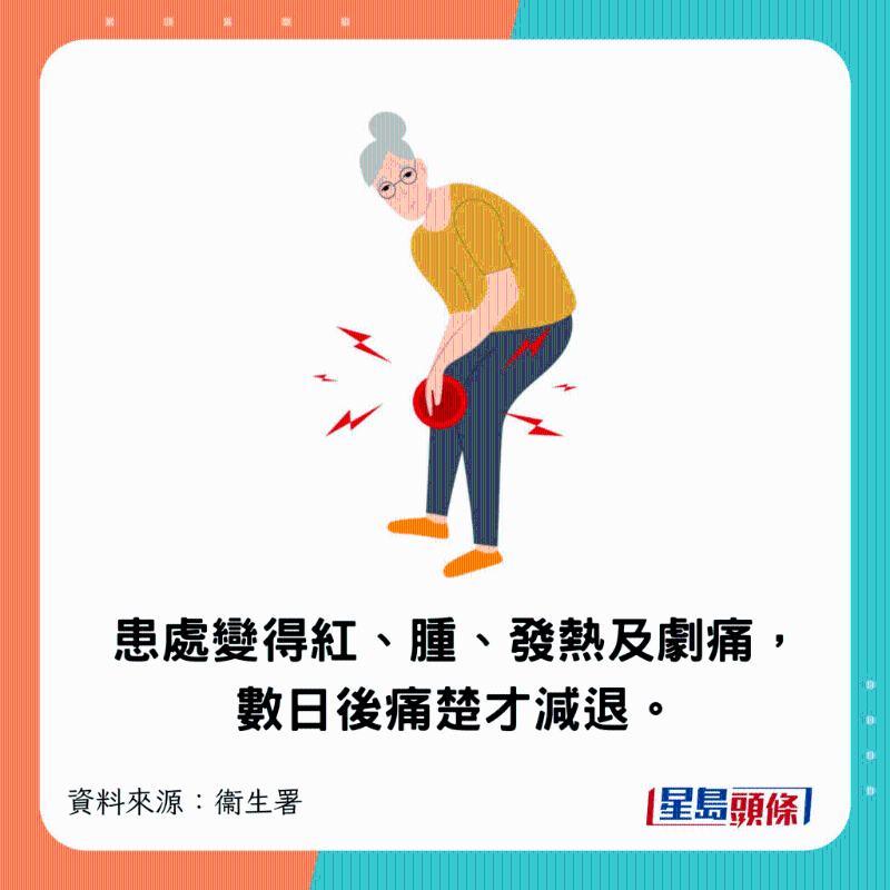 患處突然變得紅、腫、發熱及劇痛，數日后痛楚才減退。