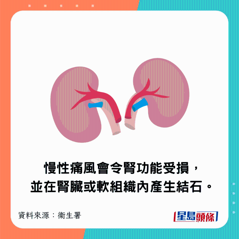 慢性痛風會令腎功能受損，并在腎臟或軟組織內產生結石。