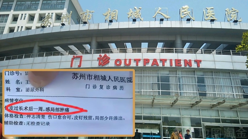 江蘇蘇州市相城人民醫院擺大烏龍，女病人竟被診斷包皮過長。