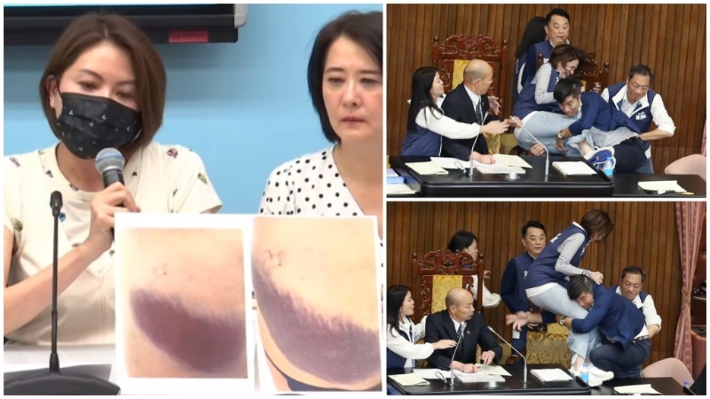 女議員陳菁徽（左）在記者會上公開照片，指受傷不輕?！∨_灣中時新聞網