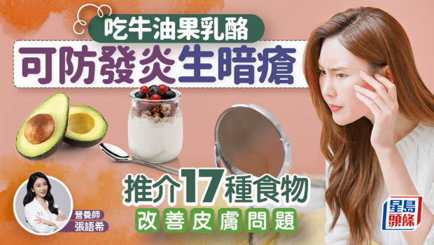 吃牛油果奶酪可防發炎生暗瘡？