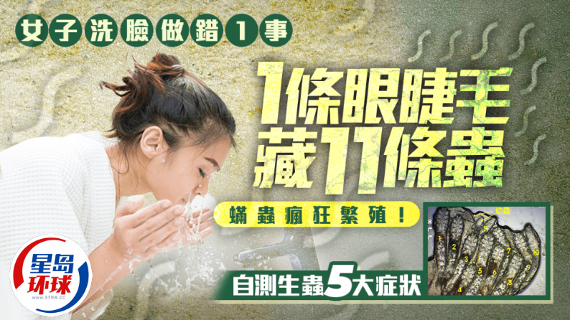 自測生蟲5大癥狀