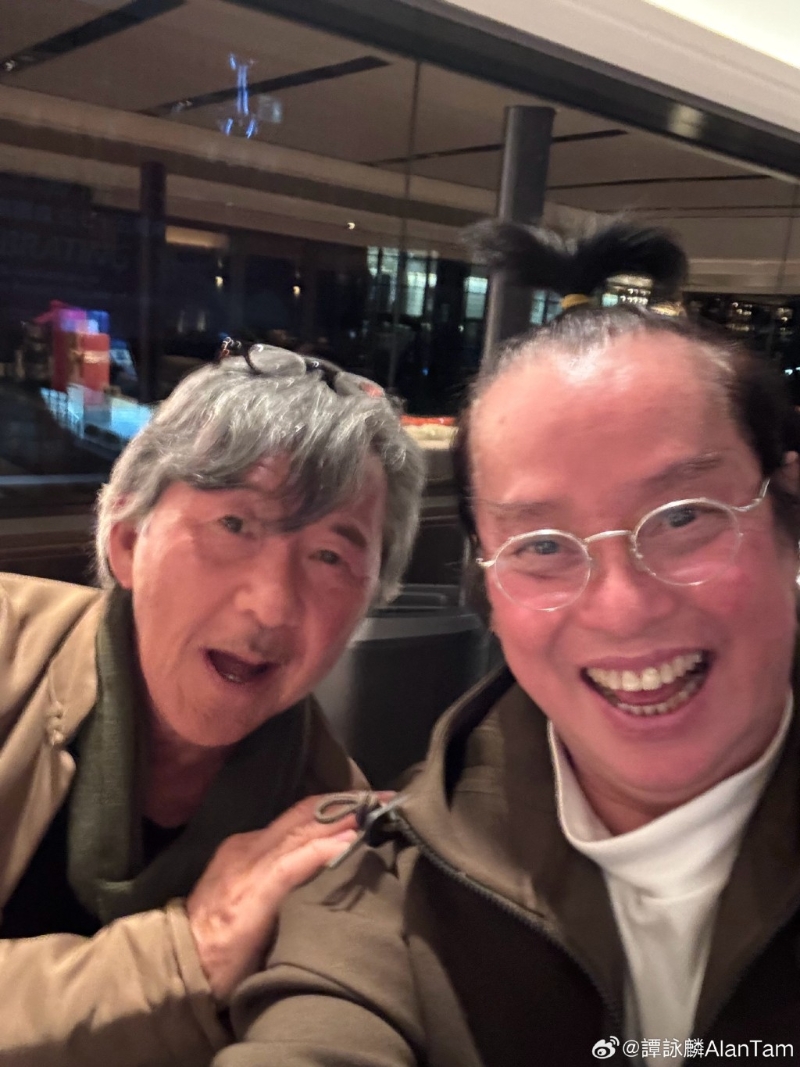 其他網民則留言：「阿倫你的發際線是心形」、「那是愛我們的形狀」、「美人尖」。