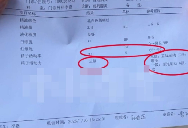 醫院人員解釋李先生精子太活躍?！缎±驇兔Α奉l道