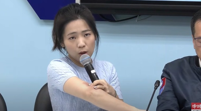 國民黨立委徐巧芯秀傷痕照。（取自直播）