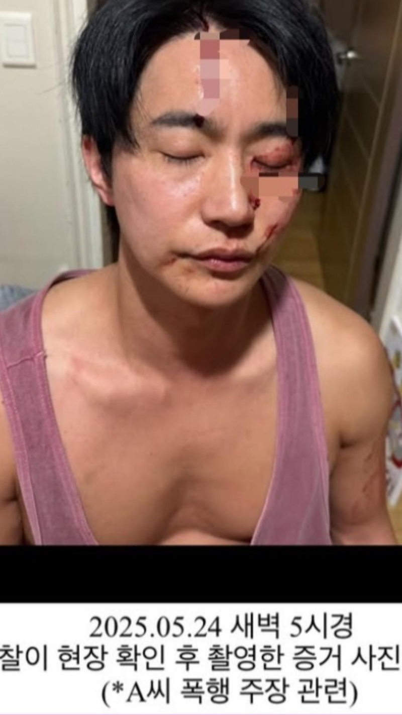 全浩俊曬出鼻青臉腫的照片回應。 （TVBS新聞網圖片）